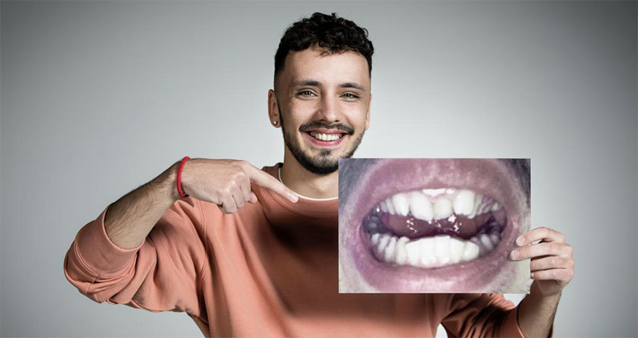 Dr Smile : comprendre les tarifs des aligneurs dentaires